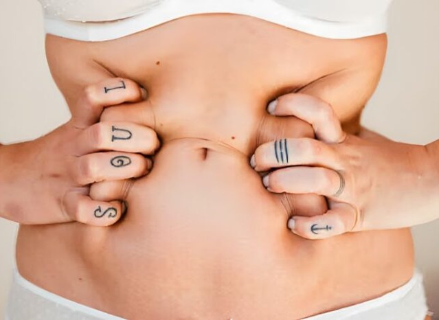 Tummy Tuck in Islamabad