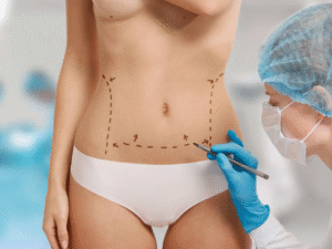 Can You Get Pregnant After a Tummy Tuck in Riyadh?