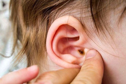 Can Ear Reshaping Surgery Fix Asymmetrical Ears?
