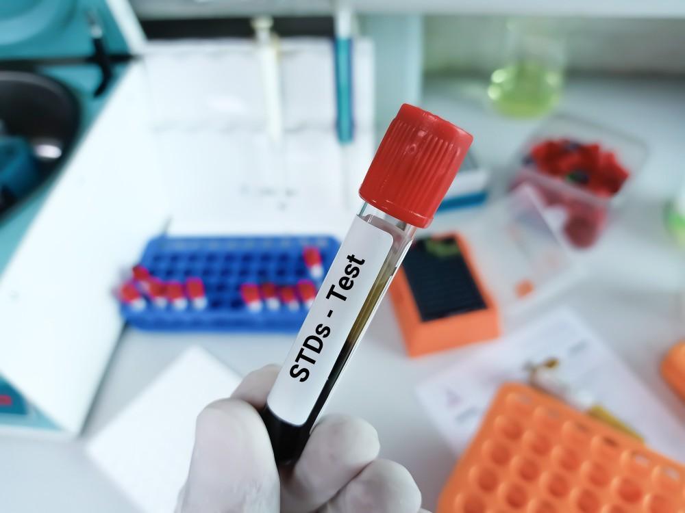 Can an STD Test Detect Multiple Infections?