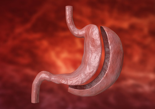 Best Bariatric Surgeon in Islamabad – A Life-Changing Decision