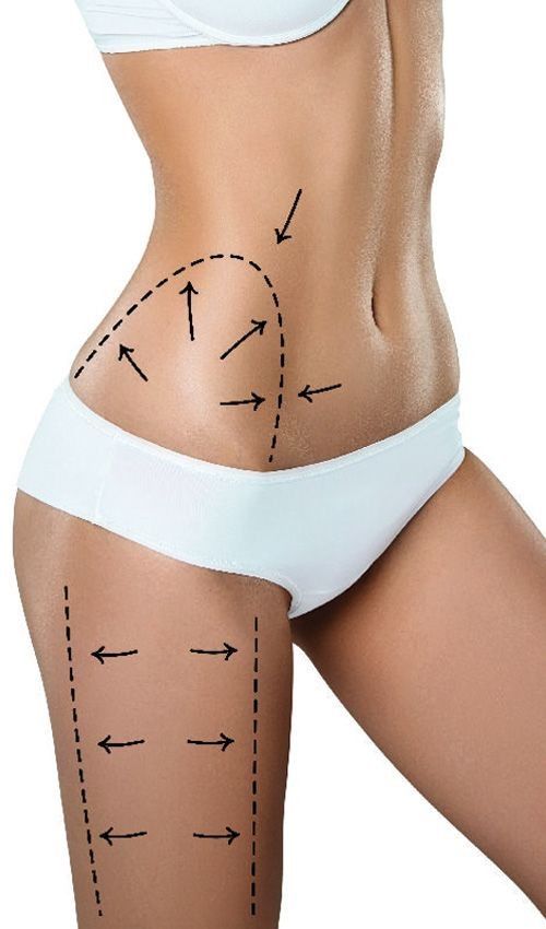 Body Sculpting Techniques in Riyadh: Modern Approaches to Fat Removal
