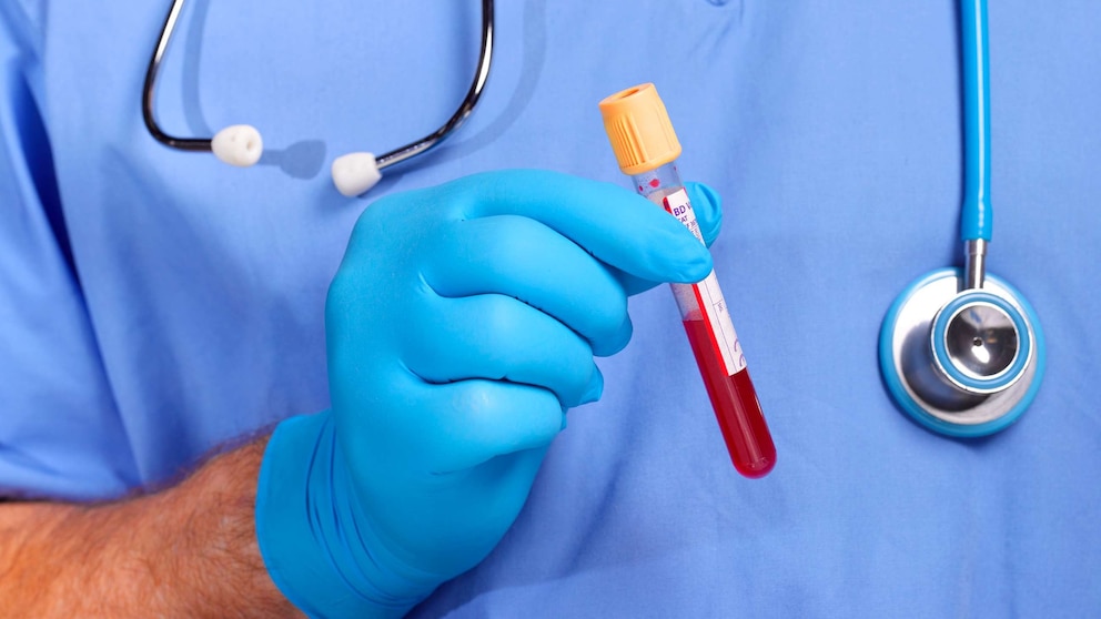 Blood Test at Home: What Doctors Wish You Knew