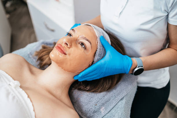 Chemical Peels in Riyadh
