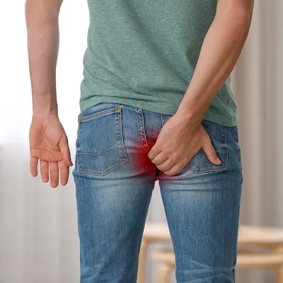 Hemorrhoids By Laser in Riyadh KSA