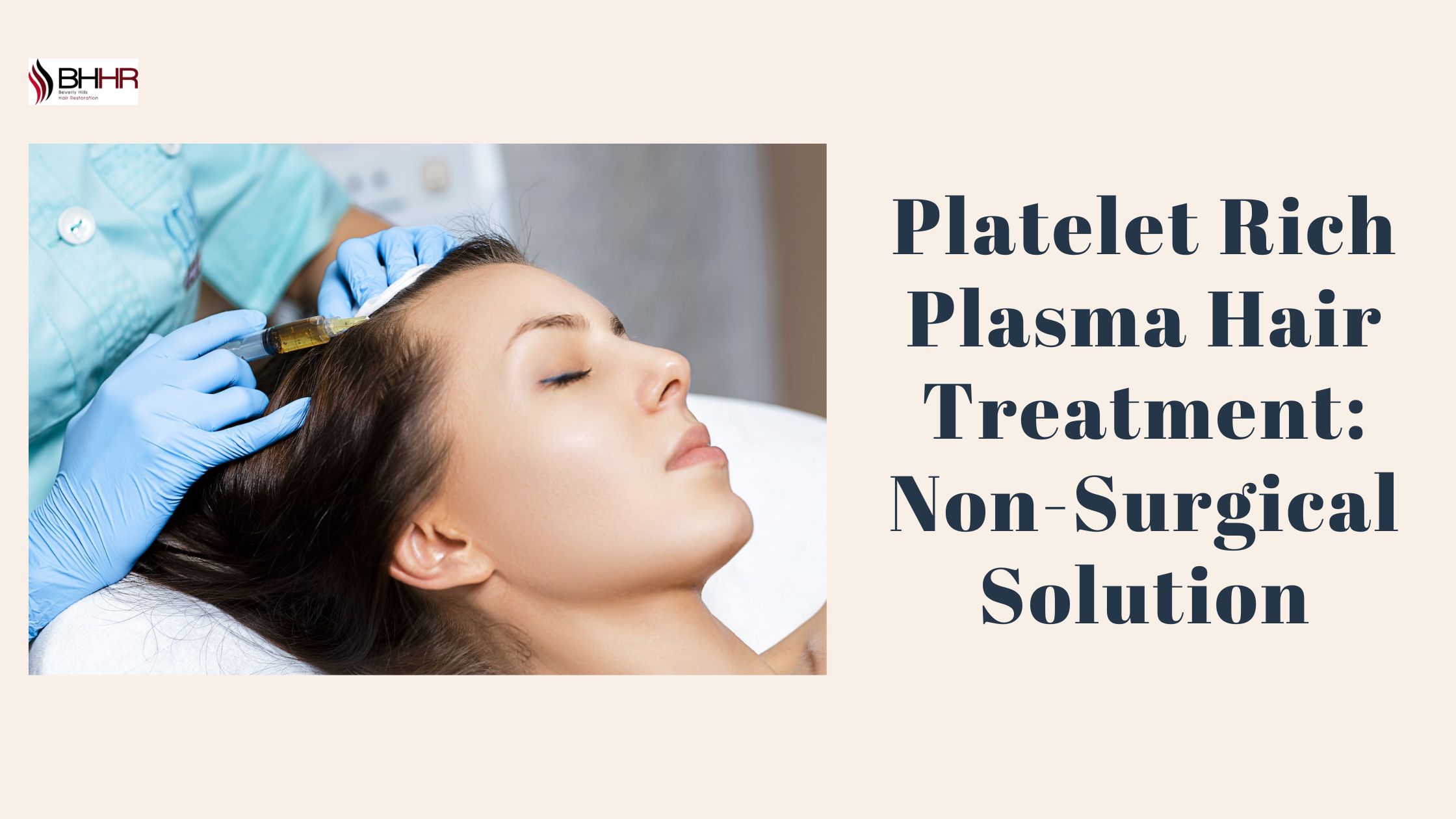 platelet rich plasma hair treatment