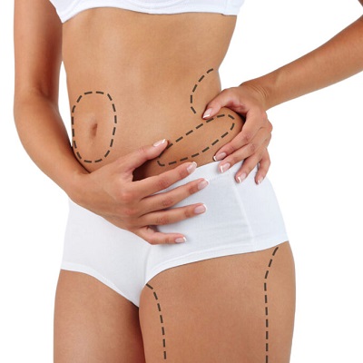 liposuction in riyadh jeddah