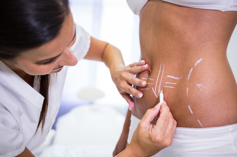 physiq body contouring