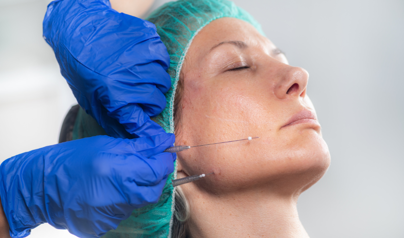 Aesthetic Threads Market