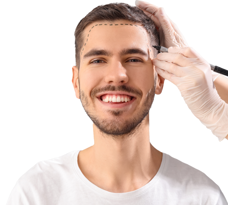 Hair Transplant in Riyadh