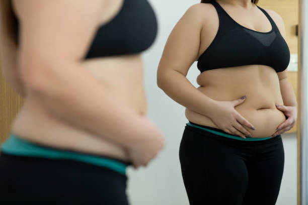 Liposuction in Dubai