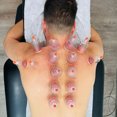 hijama for hihht blodd pressure in Riyadh