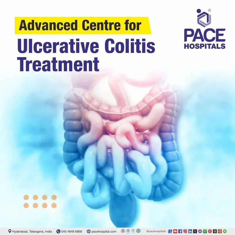 Ulcerative colitis treatment