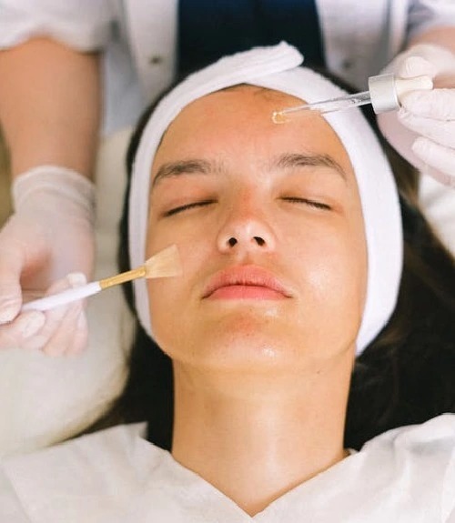 Chemical peel in Islamabad