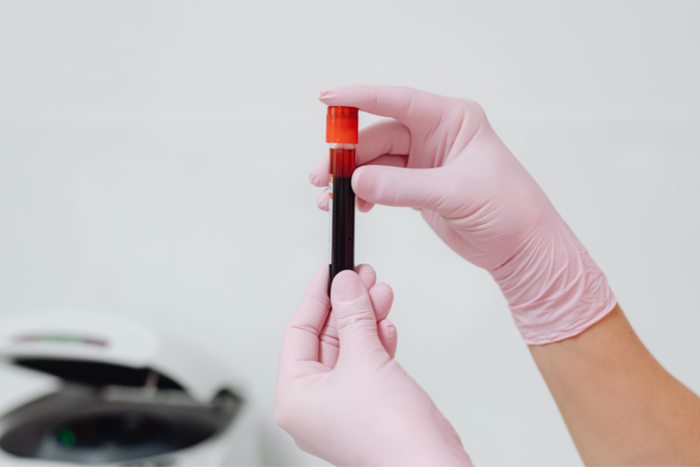 How Often Should You Get a Blood Test