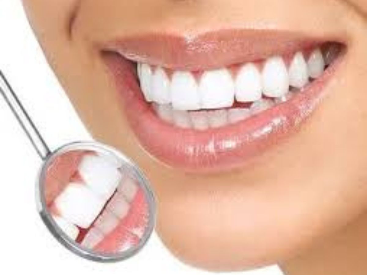 Transform Your Smile with Cosmetic Dentistry & Dental Implants Sherman Oaks