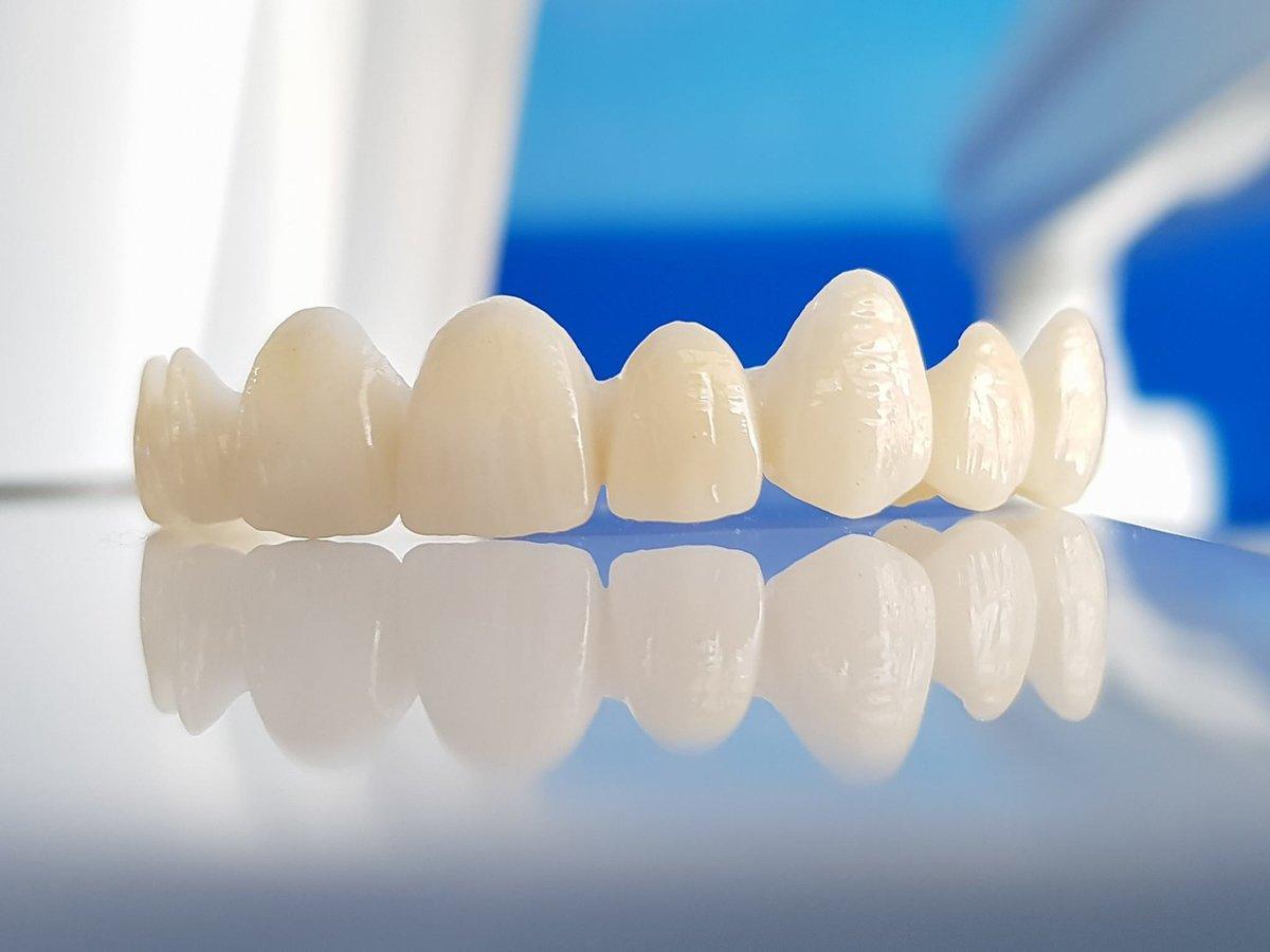 Zirconia Crown in Islamabad