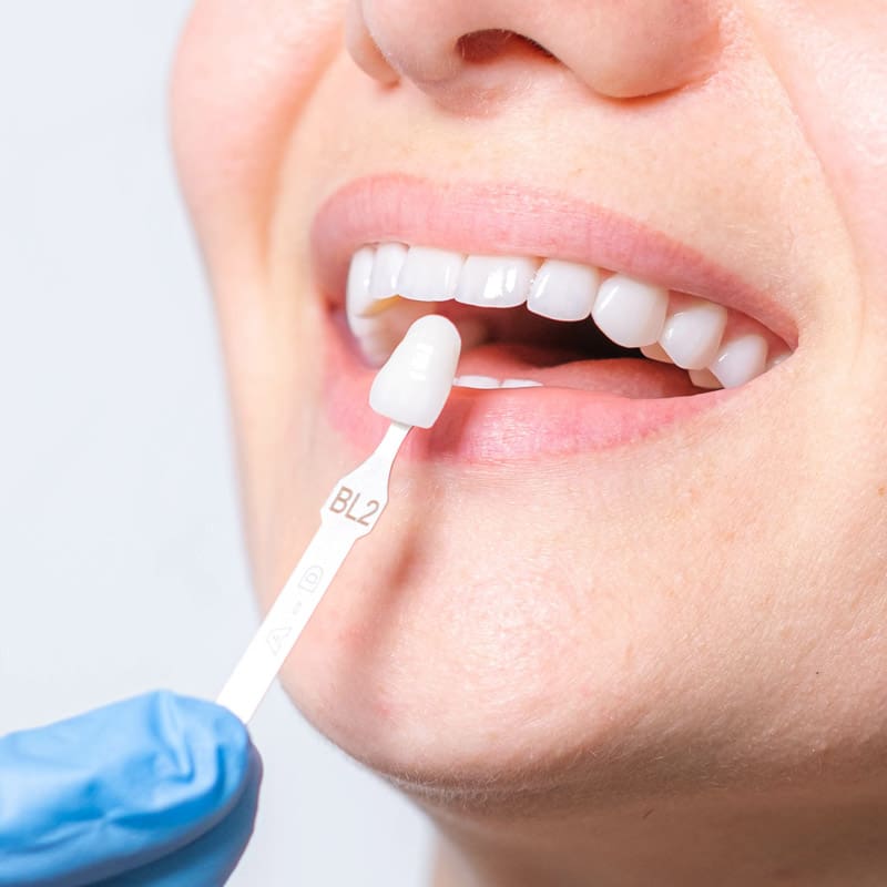 Dental Implants in Islamabad