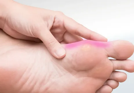 How to Reduce Forefoot Pain with Edinburgh Specialists
