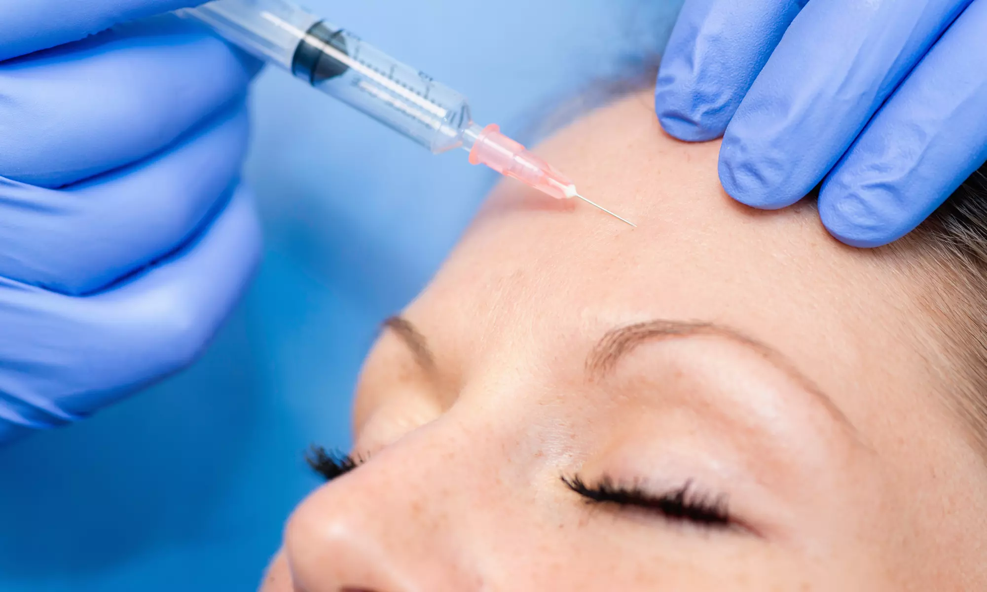 Botox Treatment