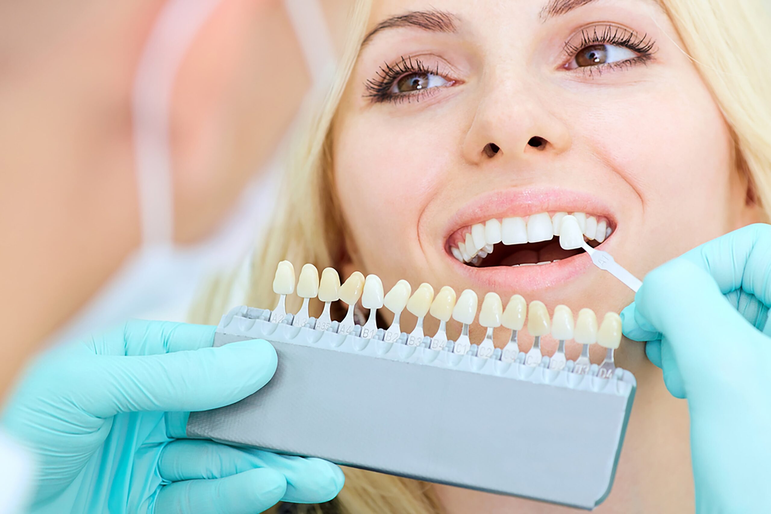 Teeth whitening in Islamabad
